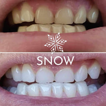 Load image into Gallery viewer, Whiten From Home With The Snow Teeth Whitening™ System
