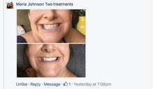 Load image into Gallery viewer, The Award Winning SNOW Teeth Whitening™ System