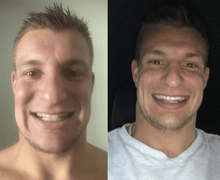 Load image into Gallery viewer, Whiten From Home With The Snow Teeth Whitening™ System
