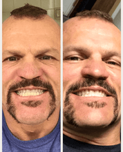 Load image into Gallery viewer, Whiten From Home With The Snow Teeth Whitening™ System
