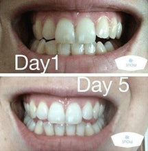 Load image into Gallery viewer, The Award Winning SNOW Teeth Whitening™ System
