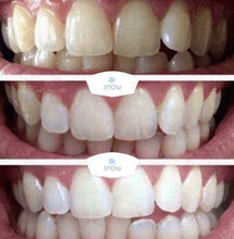 Load image into Gallery viewer, The Award Winning SNOW Teeth Whitening™ System
