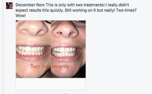 Load image into Gallery viewer, The Award Winning SNOW Teeth Whitening™ System
